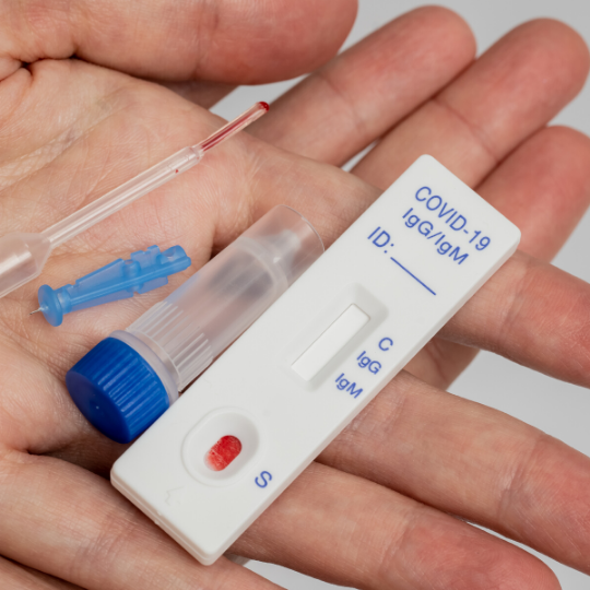 The U.S. government is shipping free COVID19 test kits. Here are the
